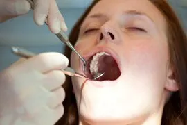 Person getting their teeth cleaned